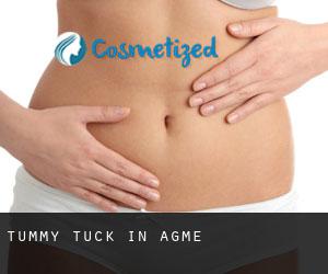 Tummy Tuck in Agmé