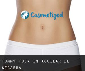 Tummy Tuck in Aguilar de Segarra