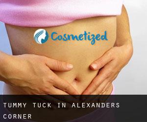 Tummy Tuck in Alexanders Corner