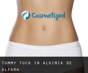Tummy Tuck in Algimia de Alfara