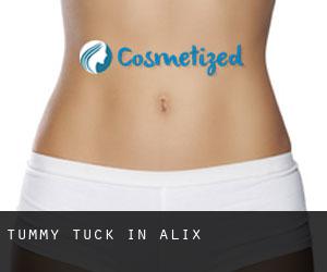 Tummy Tuck in Alix