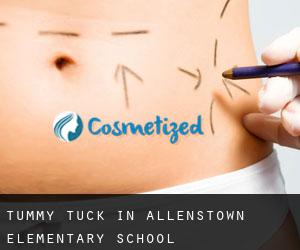 Tummy Tuck in Allenstown Elementary School
