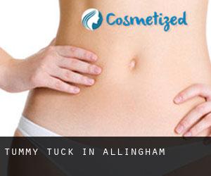 Tummy Tuck in Allingham