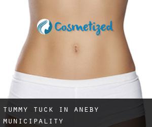 Tummy Tuck in Aneby Municipality