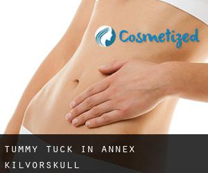 Tummy Tuck in Annex Kilvorskull