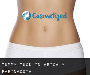 Tummy Tuck in Arica y Parinacota