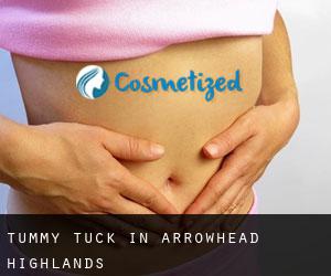 Tummy Tuck in Arrowhead Highlands