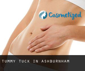 Tummy Tuck in Ashburnham