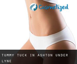 Tummy Tuck in Ashton-under-Lyne