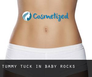 Tummy Tuck in Baby Rocks