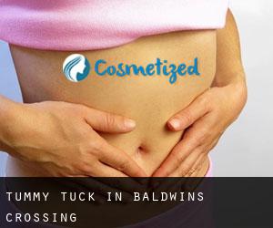 Tummy Tuck in Baldwins Crossing