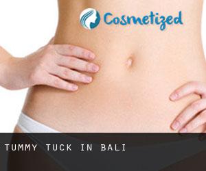 Tummy Tuck in Bali