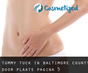 Tummy Tuck in Baltimore County door plaats - pagina 5