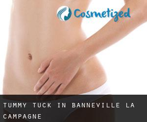 Tummy Tuck in Banneville-la-Campagne