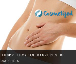 Tummy Tuck in Banyeres de Mariola