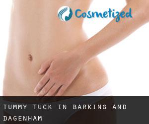 Tummy Tuck in Barking and Dagenham