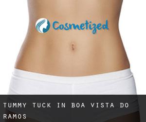 Tummy Tuck in Boa Vista do Ramos