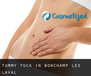 Tummy Tuck in Bonchamp-lès-Laval