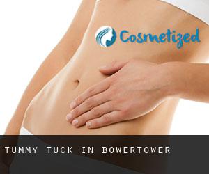 Tummy Tuck in Bowertower