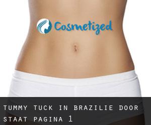 Tummy Tuck in Brazilië door Staat - pagina 1