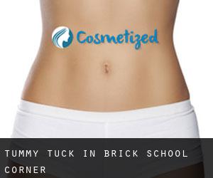 Tummy Tuck in Brick School Corner