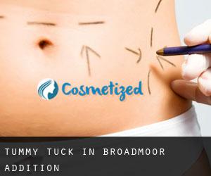 Tummy Tuck in Broadmoor Addition