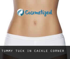 Tummy Tuck in Cackle Corner