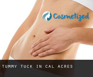Tummy Tuck in Cal Acres