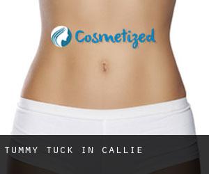 Tummy Tuck in Callie