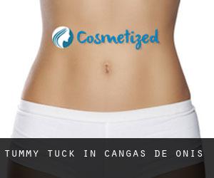 Tummy Tuck in Cangas de Onis