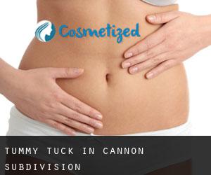 Tummy Tuck in Cannon Subdivision