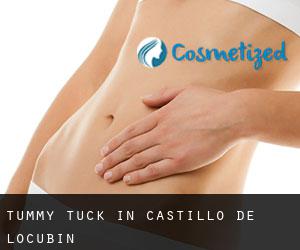 Tummy Tuck in Castillo de Locubín