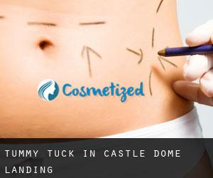 Tummy Tuck in Castle Dome Landing