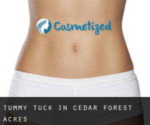 Tummy Tuck in Cedar Forest Acres