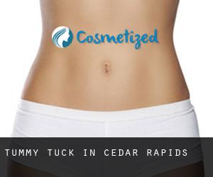 Tummy Tuck in Cedar Rapids