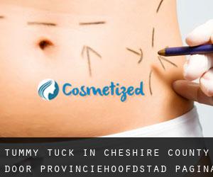 Tummy Tuck in Cheshire County door provinciehoofdstad - pagina 3