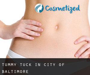 Tummy Tuck in City of Baltimore