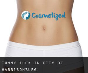 Tummy Tuck in City of Harrisonburg