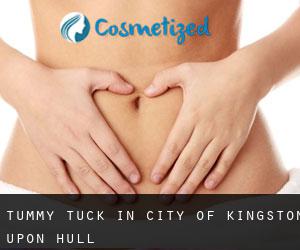 Tummy Tuck in City of Kingston upon Hull