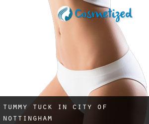 Tummy Tuck in City of Nottingham