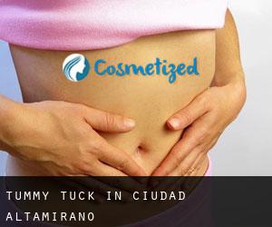Tummy Tuck in Ciudad Altamirano