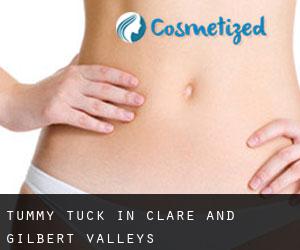 Tummy Tuck in Clare and Gilbert Valleys