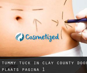 Tummy Tuck in Clay County door plaats - pagina 1