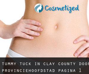 Tummy Tuck in Clay County door provinciehoofdstad - pagina 1