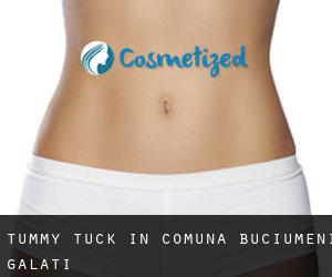 Tummy Tuck in Comuna Buciumeni (Galaţi)