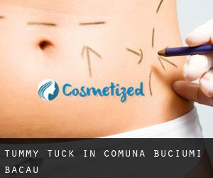 Tummy Tuck in Comuna Buciumi (Bacău)