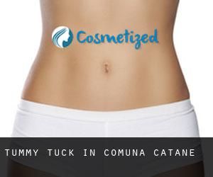 Tummy Tuck in Comuna Catane