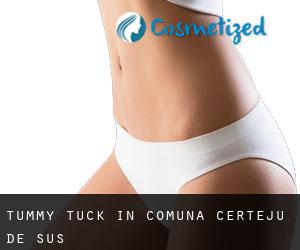 Tummy Tuck in Comuna Certeju de Sus