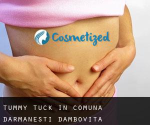 Tummy Tuck in Comuna Dărmăneşti (Dâmboviţa)