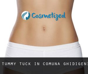 Tummy Tuck in Comuna Ghidigeni